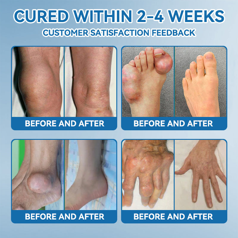 Juxek⢠BPC-157 Joint Healing Cream đŚ´Treats Arthritis, Neuropathy, Rheumatism, Sports Injuries & Moređ