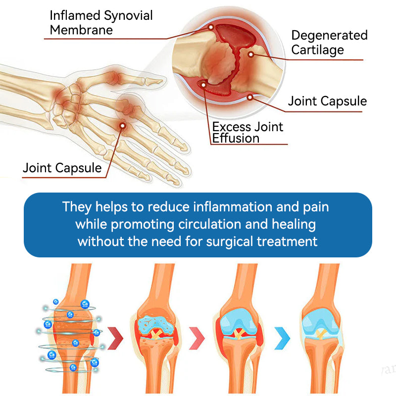 Juxek⢠BPC-157 Joint Healing Cream đŚ´Treats Arthritis, Neuropathy, Rheumatism, Sports Injuries & Moređ