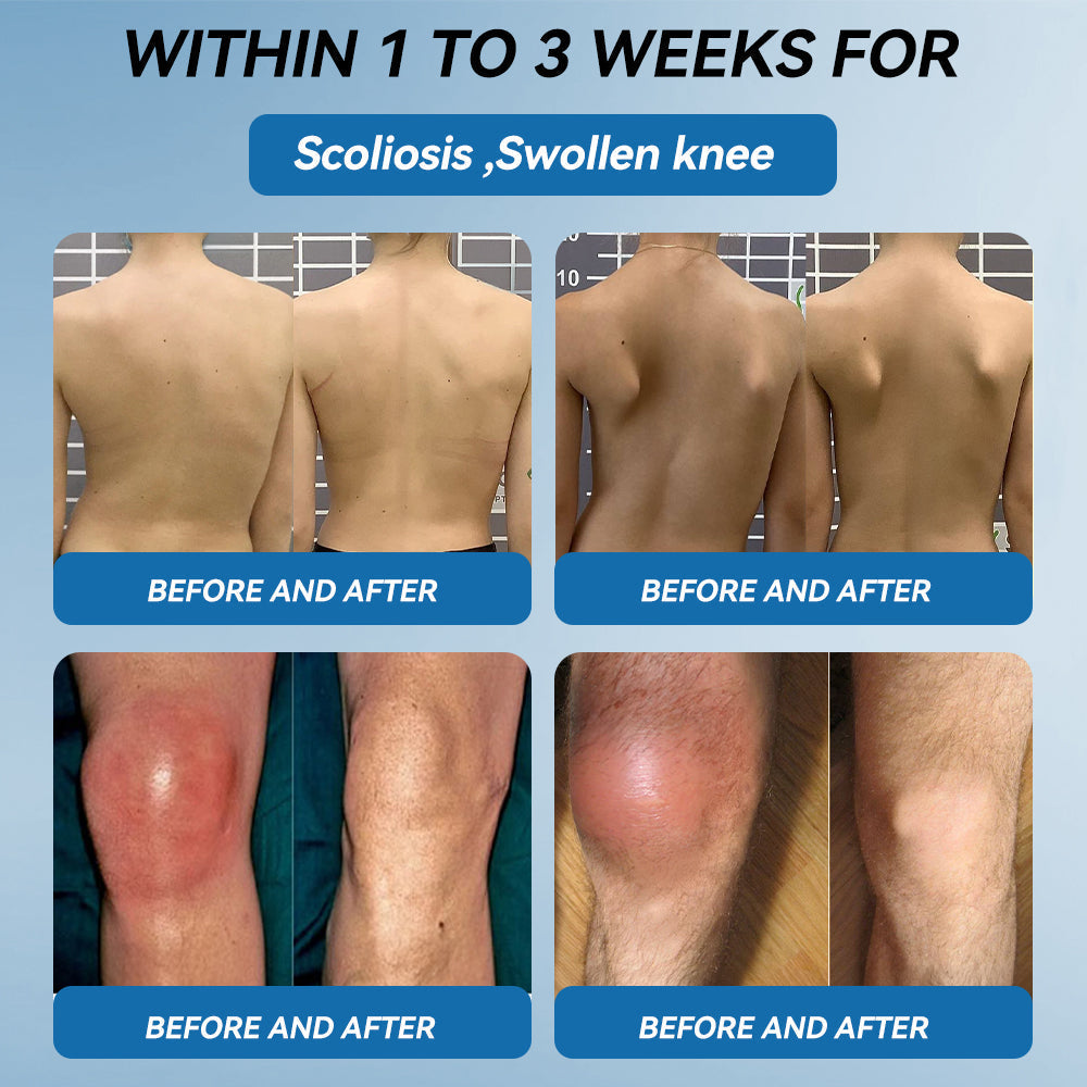 Juxek⢠BPC-157 Joint Healing Cream đŚ´Treats Arthritis, Neuropathy, Rheumatism, Sports Injuries & Moređ