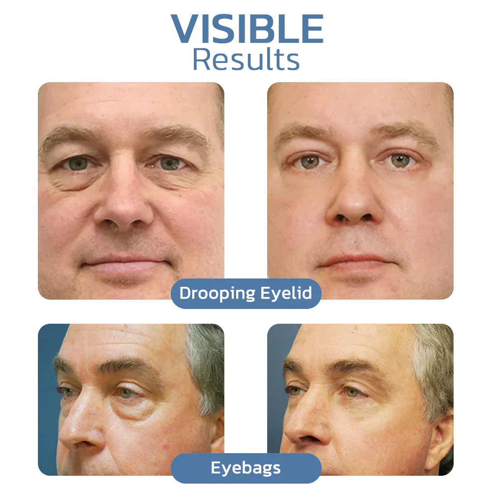 đFinal Day: 82% OFFđ LOVILDS⢠Awaken Peptide Lifting Eye Gel-$