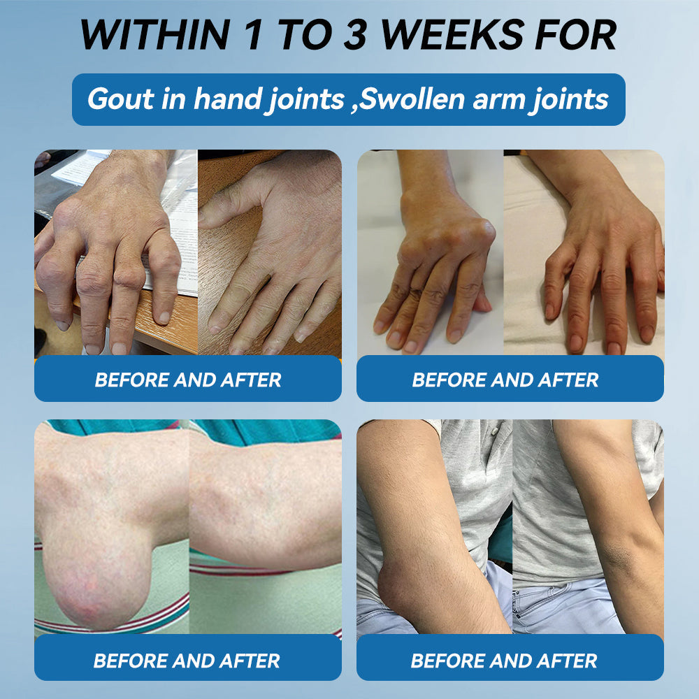 Juxek™ BPC-157 Joint Healing Cream 🦴Treats Arthritis, Neuropathy, Rheumatism, Sports Injuries & More👍