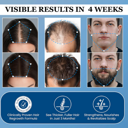 Juxek® Hair Growth Roll on Serum