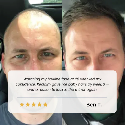 Juxek® Hair Growth Roll on Serum