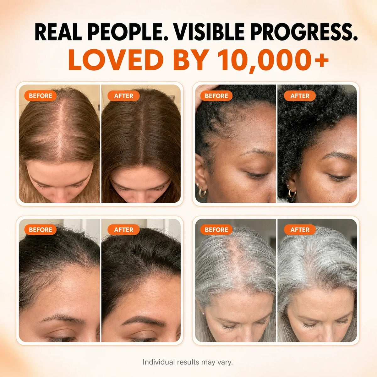 Korea's #1 Hair Growth Serum