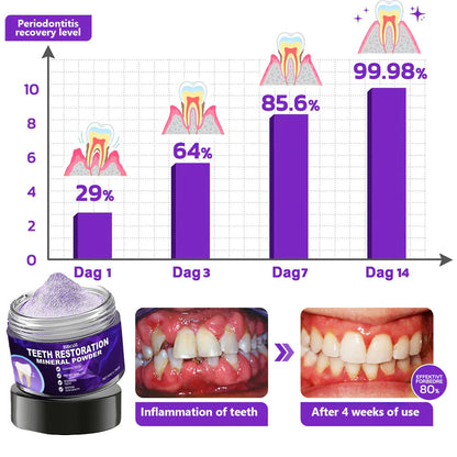 🎁BBOJI™ Limited-Time Offer🎁 - Don't miss out! Tooth Repair Mineral Powder (Treats periodontitis and oral ulcers, prevents tooth loss, and repairs gum recession)